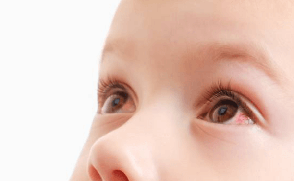 Baby:6apyvpgh4qy= Pink Eye