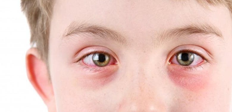 Baby:6apyvpgh4qy= Pink Eye