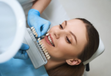 The Role Of Veneers In Cosmetic Smile Design
