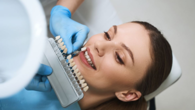 The Role Of Veneers In Cosmetic Smile Design