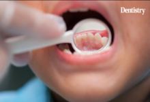 The Impact Of Parental Oral Health On Children’s Dental Outcomes