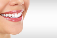 Smile Makeovers: When And Why To Consider Cosmetic Dentistry