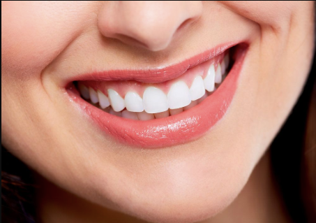 The Future Of Smile Makeovers With Implant And Cosmetic Dentistry