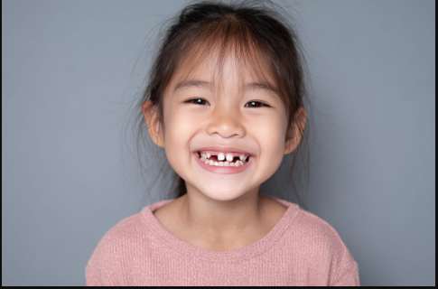 5 Post-Injury Steps For Managing Chipped Baby Teeth At Home