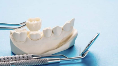 5 Common Misconceptions About Dental Crowns Debunked