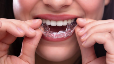 Integrating Patient Specific Occlusal Splints Into Comprehensive Smile Rehabilitation