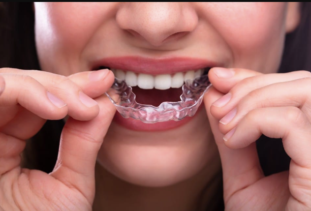 Integrating Patient Specific Occlusal Splints Into Comprehensive Smile Rehabilitation